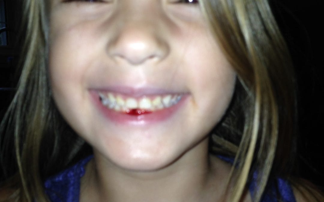 I lost my first tooth!!